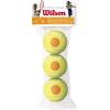WILSON Starter Tennis Balls, Yellow/Orange(Starter Orange  Ages 9-10)